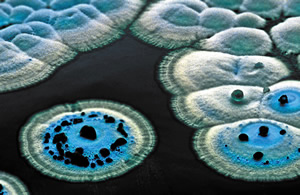 Streptomyces_coelicolor_colony